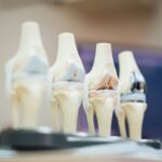Orthopedic Recovery: Faster Healing After Surgery