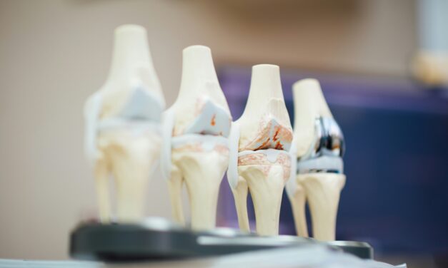 Orthopedic Recovery: Faster Healing After Surgery
