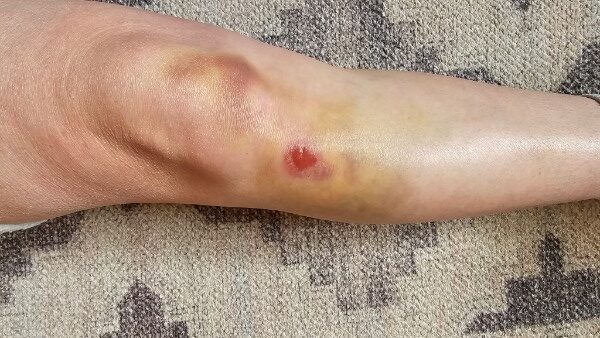 Roller Skater Life: How I Went From Fear to Fitness at 40+